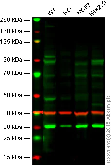 Western blot - Anti-RSK4 antibody [EP1982Y] (AB76117)