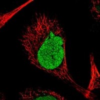 Immunocytochemistry/ Immunofluorescence - Anti-RSPH4A antibody (AB122157)