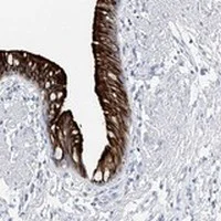 Immunohistochemistry (Formalin/PFA-fixed paraffin-embedded sections) - Anti-RSPH4A antibody (AB122157)