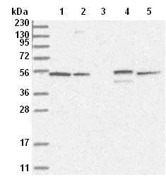 Western blot - Anti-RSPH4A antibody (AB122157)