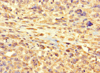 Immunohistochemistry (Formalin/PFA-fixed paraffin-embedded sections) - Anti-RSPH9 antibody (AB223045), expandable thumbnail