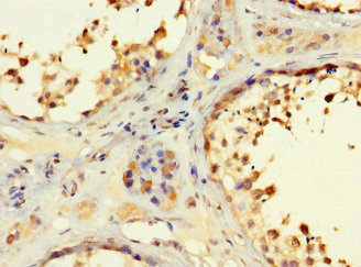Immunohistochemistry (Formalin/PFA-fixed paraffin-embedded sections) - Anti-RSPH9 antibody (AB223045), expandable thumbnail