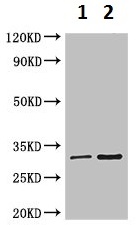 Western blot - Anti-RSPH9 antibody (AB223045), expandable thumbnail