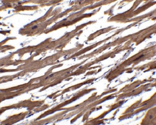 Immunohistochemistry (Formalin/PFA-fixed paraffin-embedded sections) - Anti-RSPO1 antibody (AB106556)