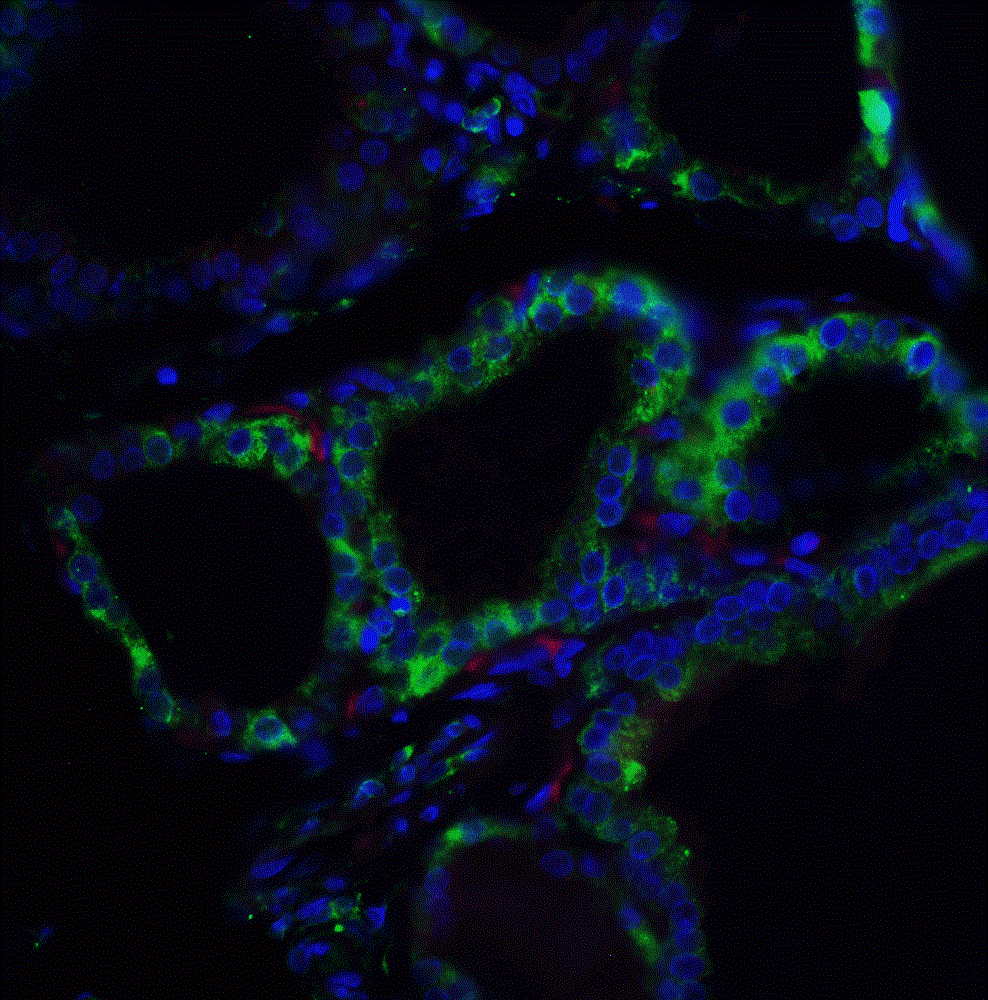 Immunohistochemistry (Formalin/PFA-fixed paraffin-embedded sections) - Anti-RSPO1 antibody (AB106556)