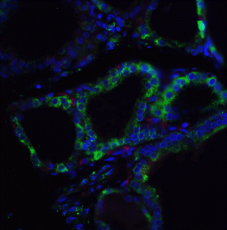 Immunohistochemistry (Formalin/PFA-fixed paraffin-embedded sections) - Anti-RSPO1 antibody (AB106556)