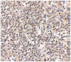 Immunohistochemistry (Formalin/PFA-fixed paraffin-embedded sections) - Anti-RSPO1 antibody (AB106556)