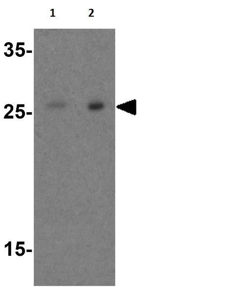 Western blot - Anti-RSPO1 antibody (AB106556)