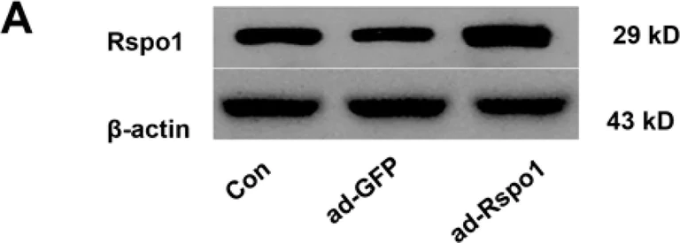 Western blot - Anti-RSPO1 antibody (AB106556)