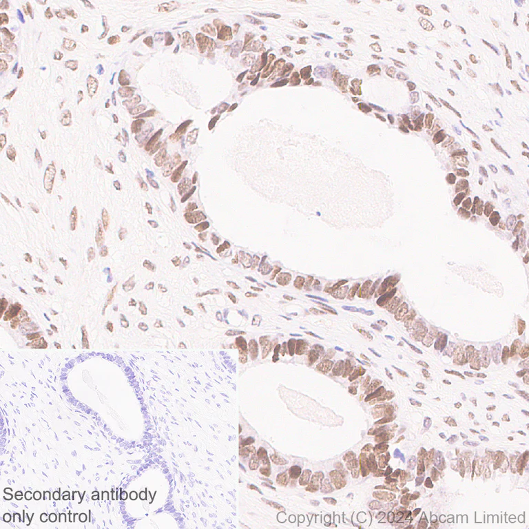 Immunohistochemistry (Formalin/PFA-fixed paraffin-embedded sections) - Anti-RSPO1 antibody [EPR28996-577] - BSA and Azide free (AB321800)