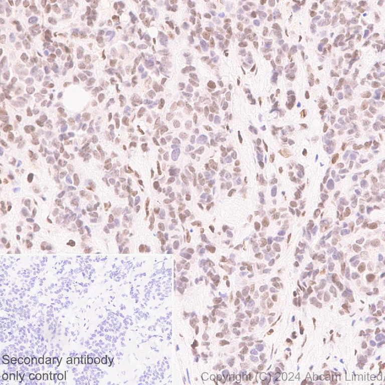 Immunohistochemistry (Formalin/PFA-fixed paraffin-embedded sections) - Anti-RSPO1 antibody [EPR28996-577] - BSA and Azide free (AB321800)