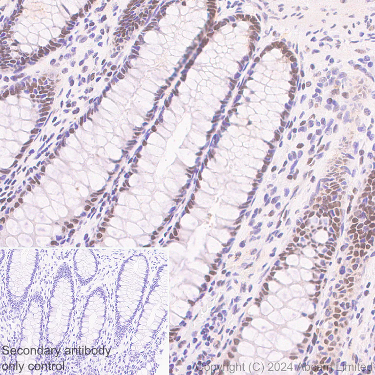 Immunohistochemistry (Formalin/PFA-fixed paraffin-embedded sections) - Anti-RSPO1 antibody [EPR28996-577] - BSA and Azide free (AB321800)