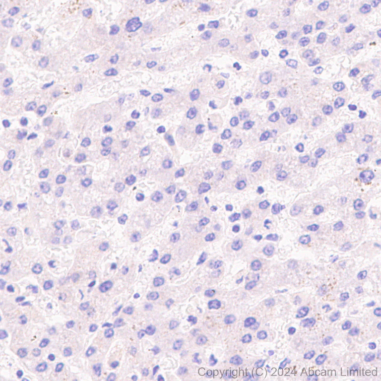 Immunohistochemistry (Formalin/PFA-fixed paraffin-embedded sections) - Anti-RSPO1 antibody [EPR28996-577] - BSA and Azide free (AB321800)