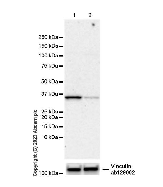 Western blot - Anti-RSPO2 antibody [EPR26083-79] (AB314114)