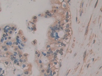 Immunohistochemistry (Formalin/PFA-fixed paraffin-embedded sections) - Anti-RSPO3 antibody (AB233113)