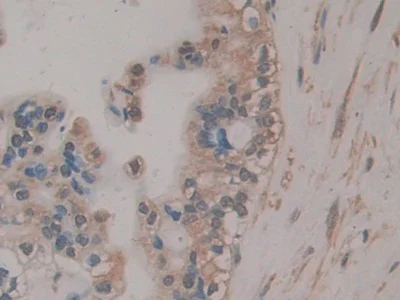 Immunohistochemistry (Formalin/PFA-fixed paraffin-embedded sections) - Anti-RSPO3 antibody (AB233113)