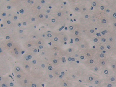 Immunohistochemistry (Formalin/PFA-fixed paraffin-embedded sections) - Anti-RSPO3 antibody (AB233113)