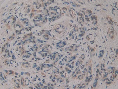 Immunohistochemistry (Formalin/PFA-fixed paraffin-embedded sections) - Anti-RSPO3 antibody (AB233113)