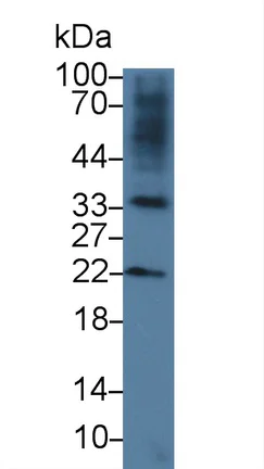 Western blot - Anti-RSPO3 antibody (AB233113)