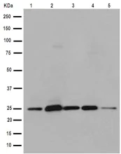 Western blot - Anti-RSPO4 antibody [EPR9806(2)] (AB189515)