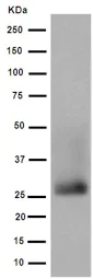 Western blot - Anti-RSPO4 antibody [EPR9806(2)] (AB189515)