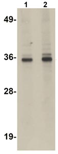 Western blot - Anti-RSRC1 antibody (AB106650), expandable thumbnail