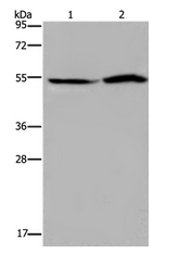 Western blot - Anti-RST antibody - C-terminal (AB198791)
