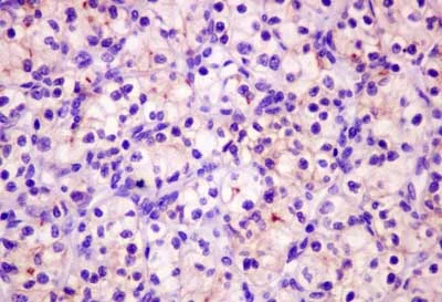 Immunohistochemistry (Formalin/PFA-fixed paraffin-embedded sections) - Anti-RST antibody [EPR12312(2)] (AB181237)