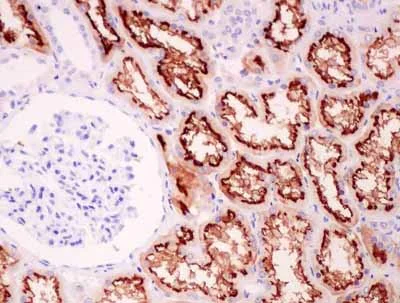 Immunohistochemistry (Formalin/PFA-fixed paraffin-embedded sections) - Anti-RST antibody [EPR12312(2)] (AB181237)