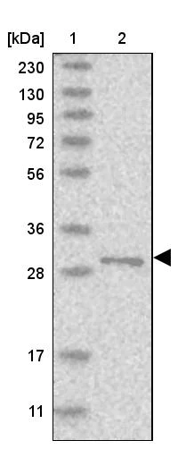 Western blot - Anti-RSU1 antibody (AB254600)