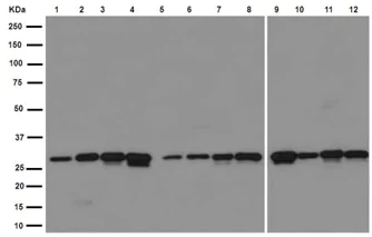 Western blot - Anti-RSU1 antibody [EPR16127] (AB191409)
