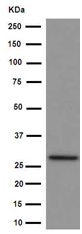 Western blot - Anti-RSU1 antibody [EPR16127] (AB191409)