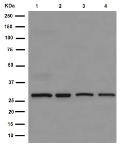 Western blot - Anti-RSU1 antibody [EPR16127] (AB191409)