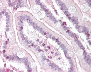 Immunohistochemistry (Formalin/PFA-fixed paraffin-embedded sections) - Anti-RTEL1 antibody (AB85557)