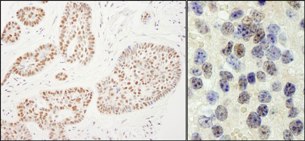 Immunohistochemistry (Formalin/PFA-fixed paraffin-embedded sections) - Anti-RTF1 antibody (AB99362)