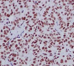Immunohistochemistry (Formalin/PFA-fixed paraffin-embedded sections) - Anti-RTF1 antibody [EPR13615] - BSA and Azide free (AB250771)