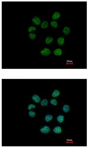 Immunocytochemistry/ Immunofluorescence - Anti-RTKN/Rhotekin antibody (ab154954), expandable thumbnail
