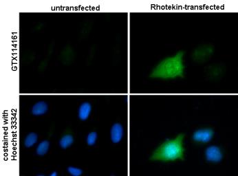 Immunocytochemistry/ Immunofluorescence - Anti-RTKN/Rhotekin antibody (AB154954), expandable thumbnail