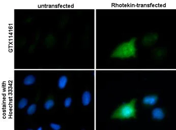 Immunocytochemistry/ Immunofluorescence - Anti-RTKN/Rhotekin antibody (AB154954)