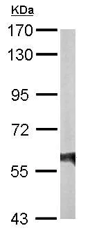 Western blot - Anti-RTKN/Rhotekin antibody (AB154954)