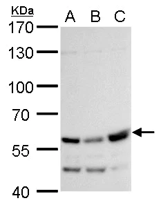 Western blot - Anti-RTKN/Rhotekin antibody (AB154954)
