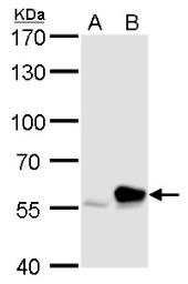 Western blot - Anti-RTKN/Rhotekin antibody (AB154954), expandable thumbnail