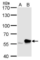 Western blot - Anti-RTKN/Rhotekin antibody (AB154954)