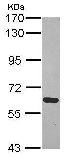 Western blot - Anti-RTKN/Rhotekin antibody (AB154954), expandable thumbnail