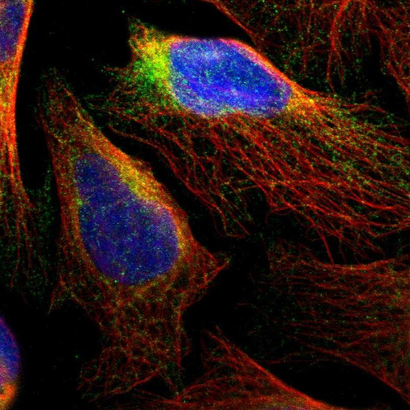 Immunocytochemistry/ Immunofluorescence - Anti-RTN3/HAP antibody (AB246911), expandable thumbnail