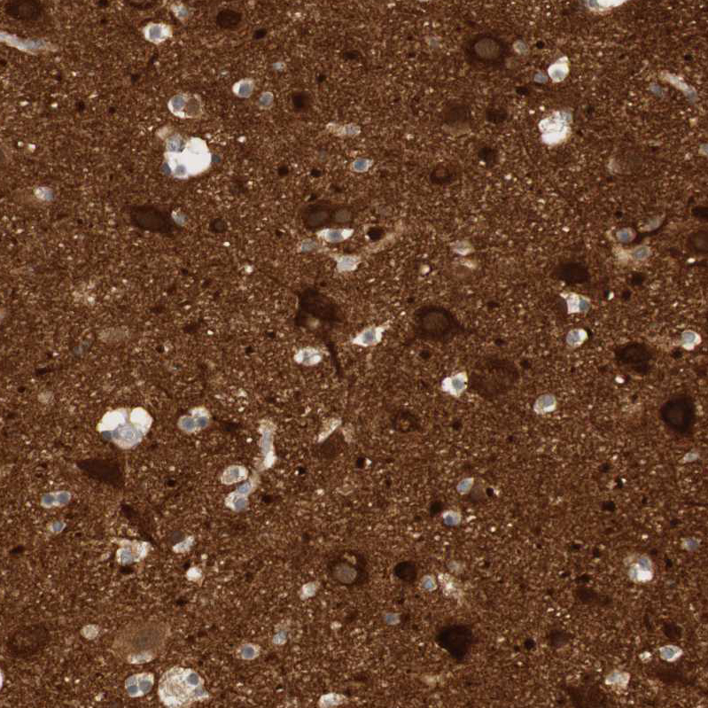 Immunohistochemistry (Formalin/PFA-fixed paraffin-embedded sections) - Anti-RTN3/HAP antibody (AB246911), expandable thumbnail