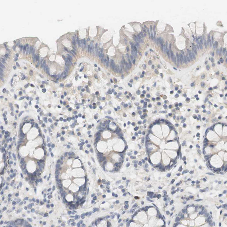 Immunohistochemistry (Formalin/PFA-fixed paraffin-embedded sections) - Anti-RTN3/HAP antibody (AB246911), expandable thumbnail