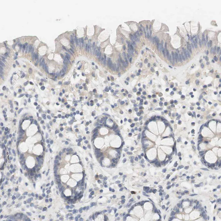 Immunohistochemistry (Formalin/PFA-fixed paraffin-embedded sections) - Anti-RTN3/HAP antibody (AB246911)