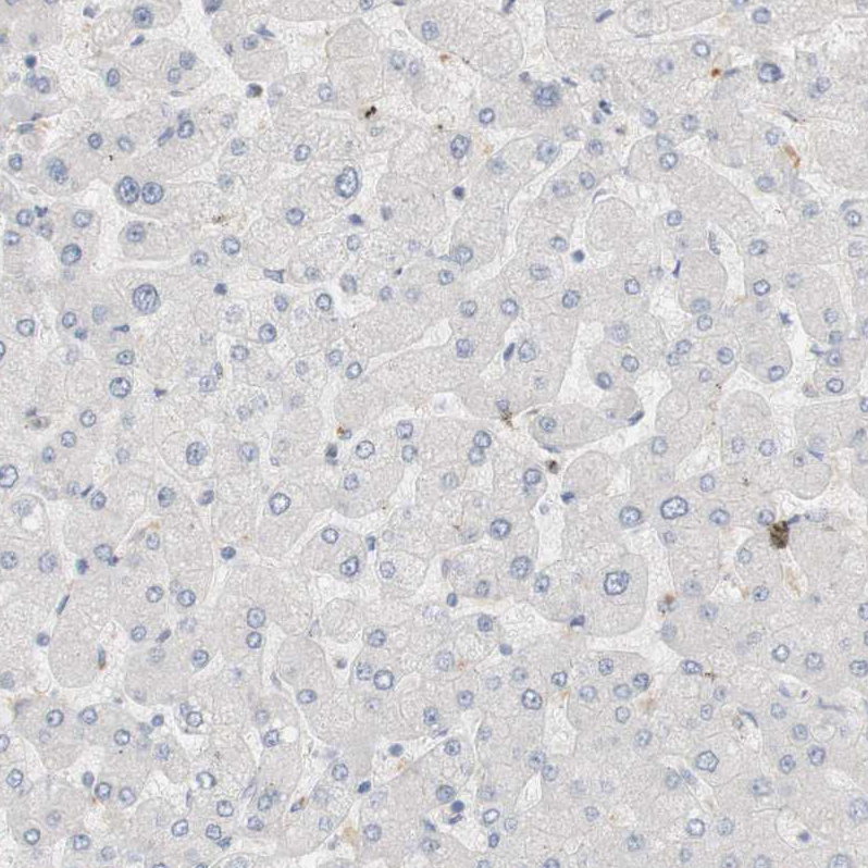 Immunohistochemistry (Formalin/PFA-fixed paraffin-embedded sections) - Anti-RTN3/HAP antibody (AB246911), expandable thumbnail