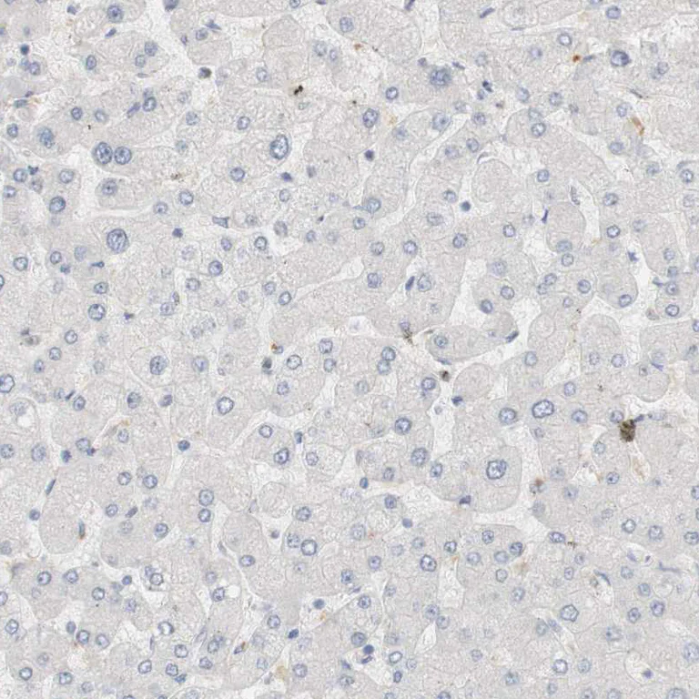 Immunohistochemistry (Formalin/PFA-fixed paraffin-embedded sections) - Anti-RTN3/HAP antibody (AB246911)